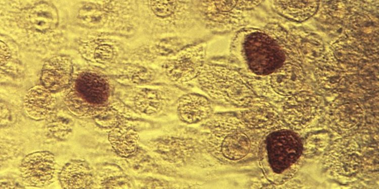 STD diagnoses jumped in recent years, especially among seniors