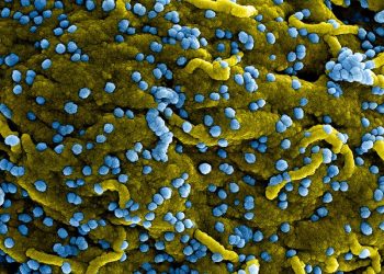 Rwanda is dealing with its first outbreak of deadly Marburg virus disease